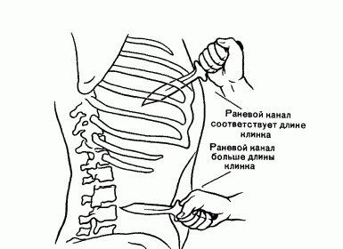 Claw.ru | Рефераты по безопасности жизнедеятельности | Повреждения, причиняемые острыми предметами