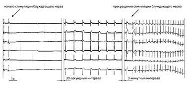 Claw.ru | Рефераты по медицине | Создание биологического водителя ритма сердца