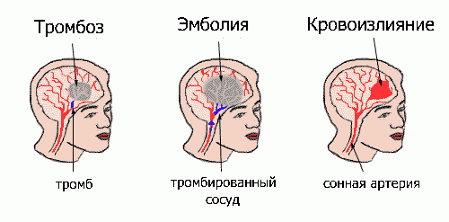 Claw.ru | Рефераты по медицине | Заболевания сердечно-сосудистой системы